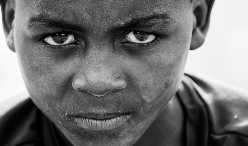 Imagem em preto em branco, menino com expressão de fome